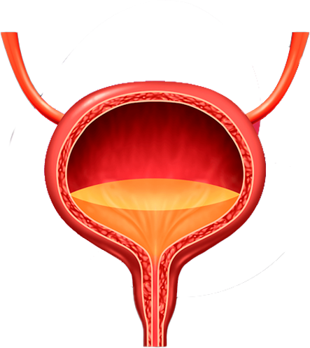 incontinenciaurinaria